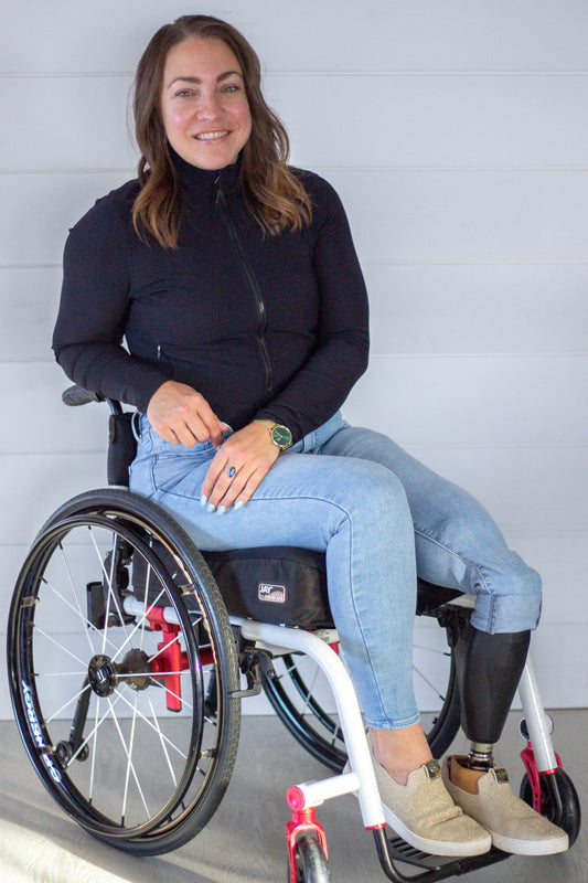 When Memory Rewrites Itself: Seven Years as an Amputee